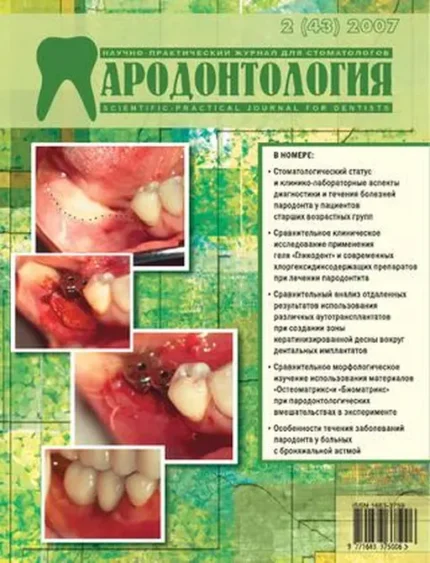 ПАРАДОНТОЛОГИЯ